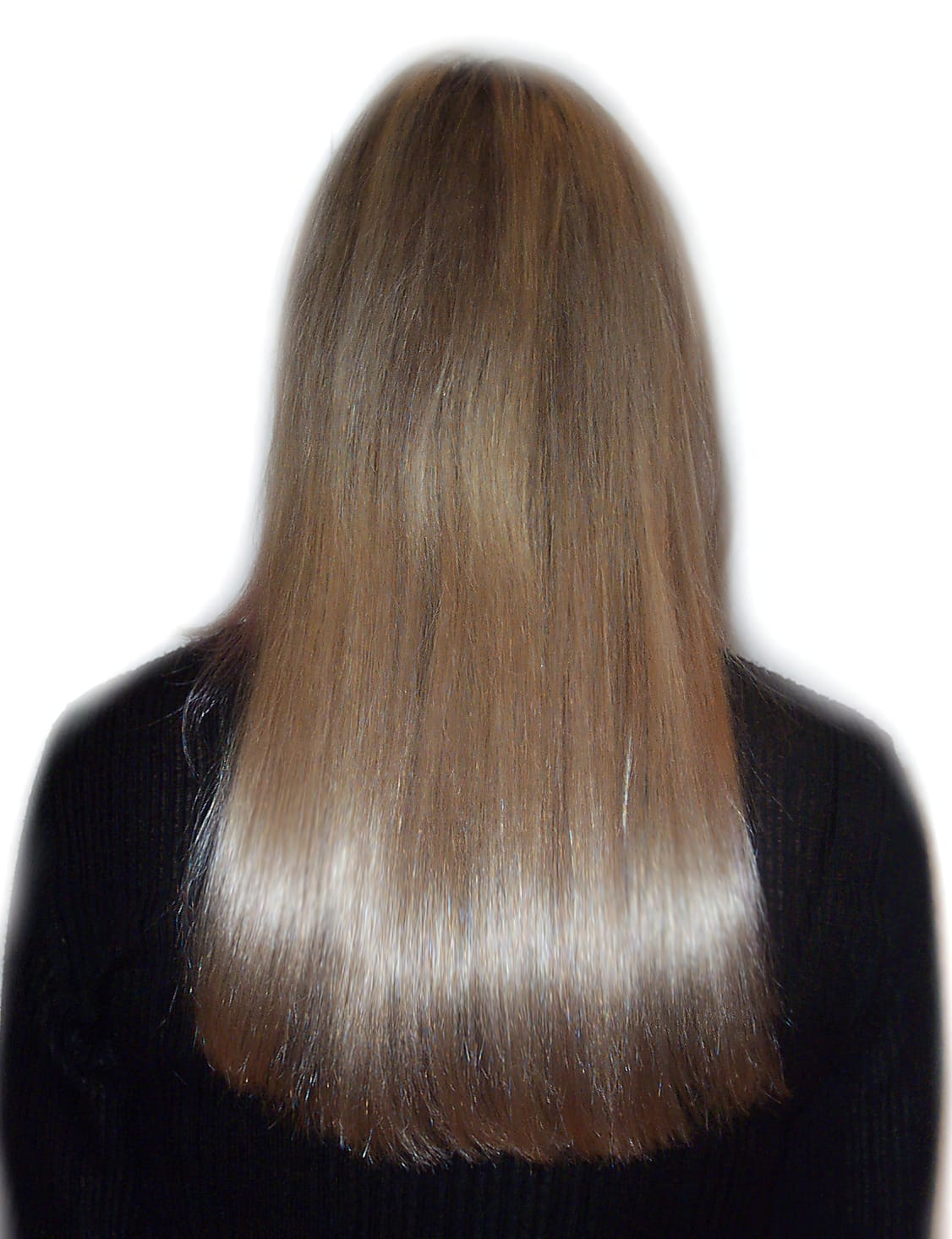 After Picture - Real Hair Extensions Bald Patches Recovery